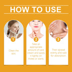 BEE VENOM Moles and Warts Treatment Cream