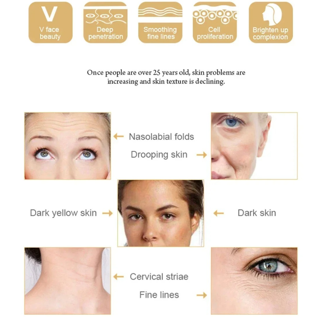 Anti-Aging RF Skin Tightening Facial Device