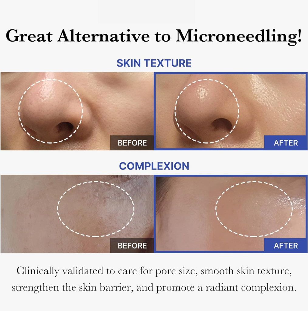 Anti Wrinkle Face Massager + 2 Exosome Serums