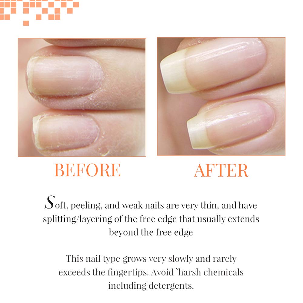 NAIL TEK The Natural Nail Experts For Healthy Nail
