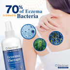 SKINSMART Antimicrobial Eczema Therapy
